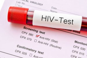 Xét nghiệm HIV càng sớm càng làm tăng hiệu quả điều trị