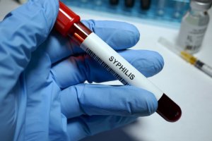 Xét nghiệm Syphilis là xét nghiệm được thực hiện nhằm sàng lọc, chẩn đoán bệnh giang mai
