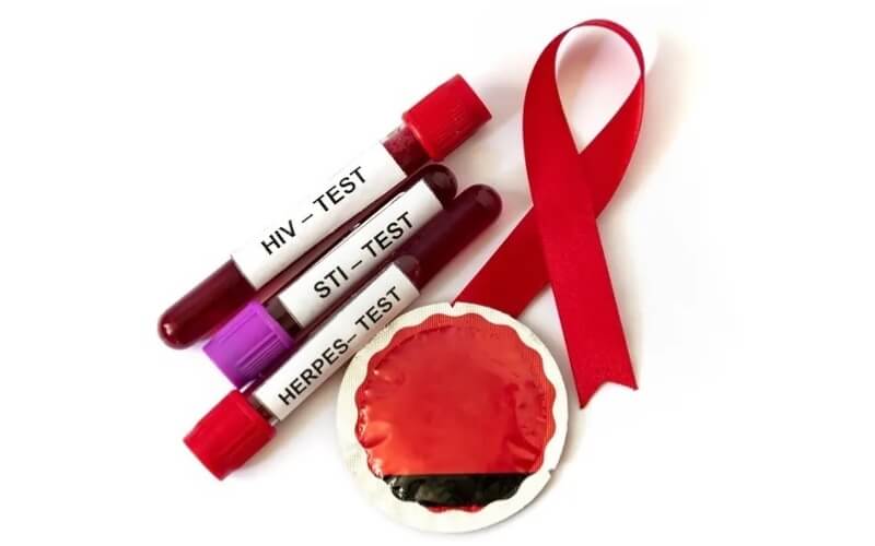 Xét nghiệm và phát hiện sớm STIs giúp giảm nguy cơ nhiễm HIV 